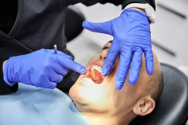 Best Emergency Wisdom Teeth Removal in South Huntington, NY